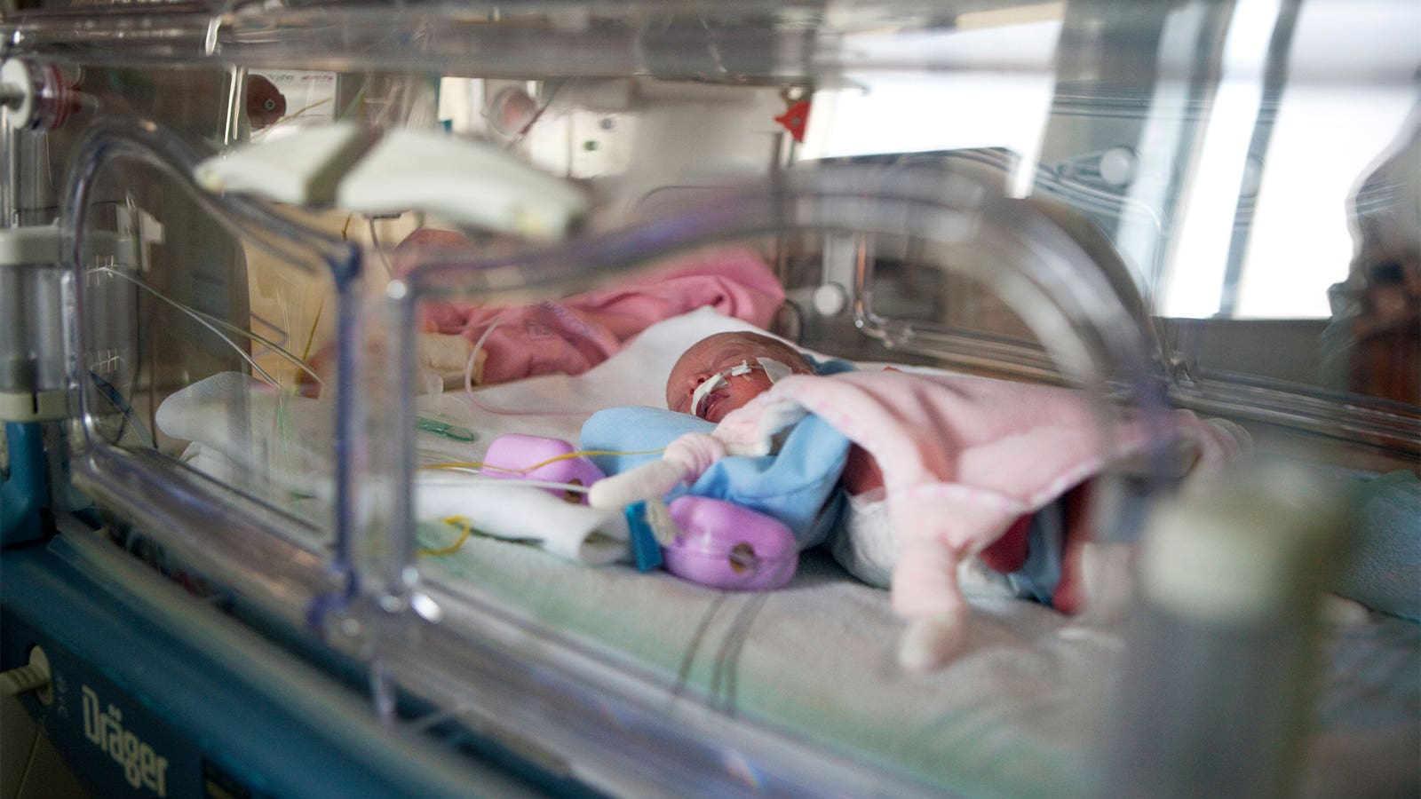 Donor Milk, Formula Go Head-to-Head for Extreme Preemies in the NICU