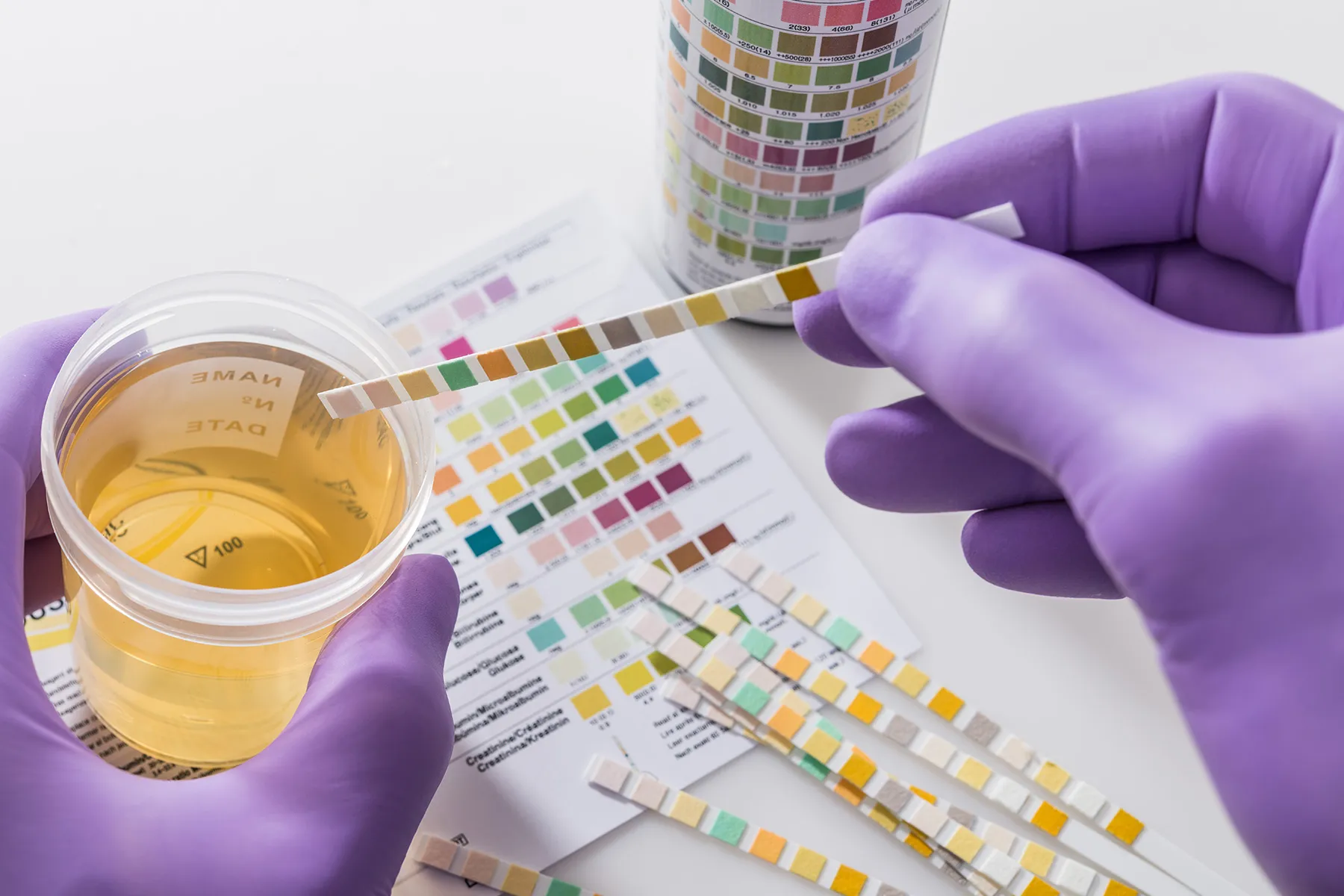 Will CBD Show Up on a Drug Test?