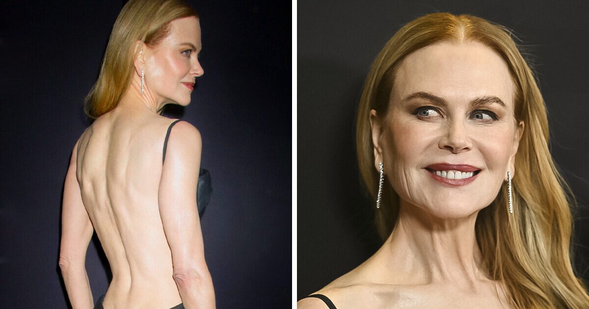 “Screams Desperation,” Nicole Kidman, 56, Stuns in a Risqué Dress, But People Say It’s Not Age-Appropriate