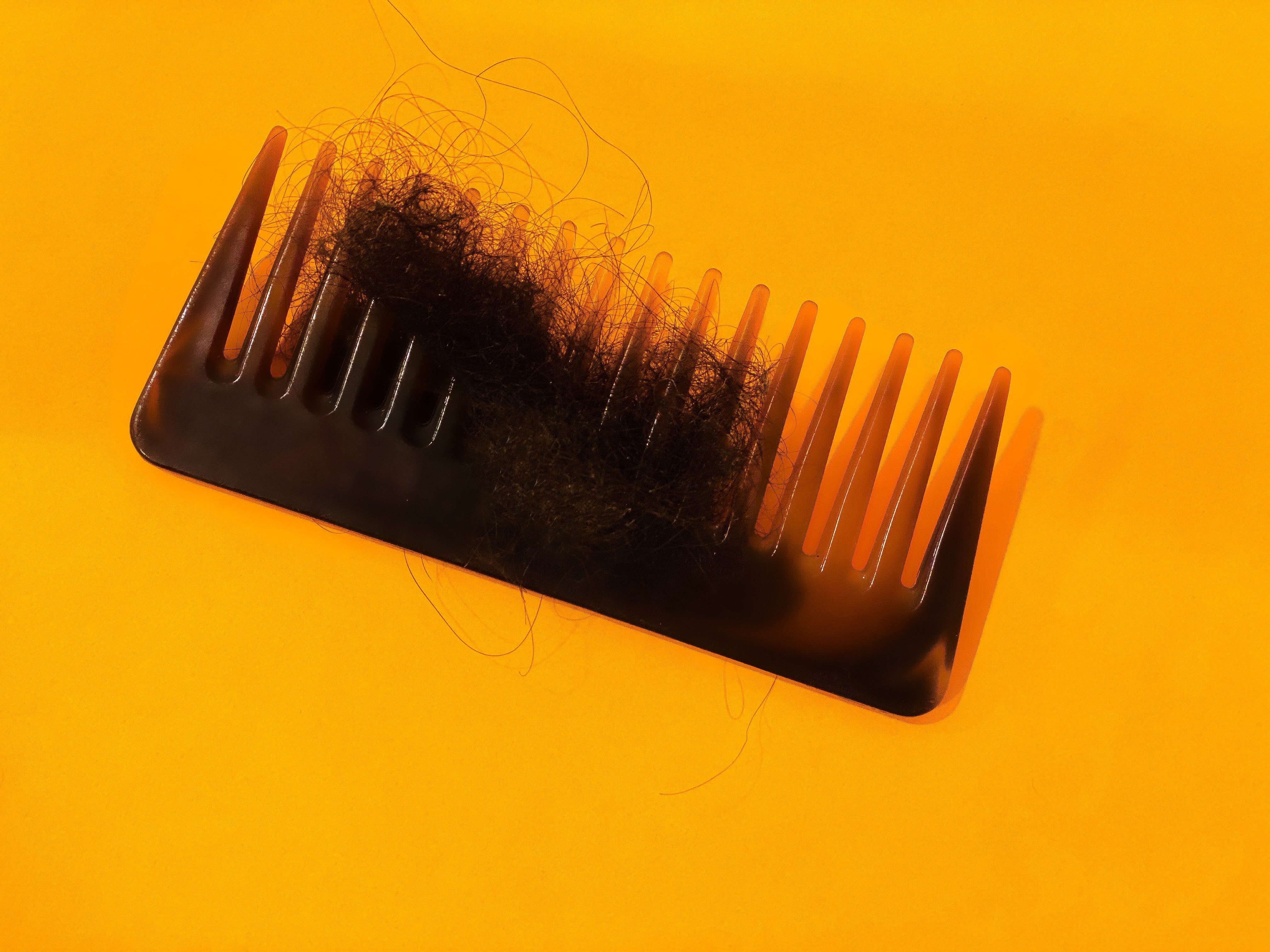 8 Causes of Hair Loss in Women That Have Nothing to Do With Age