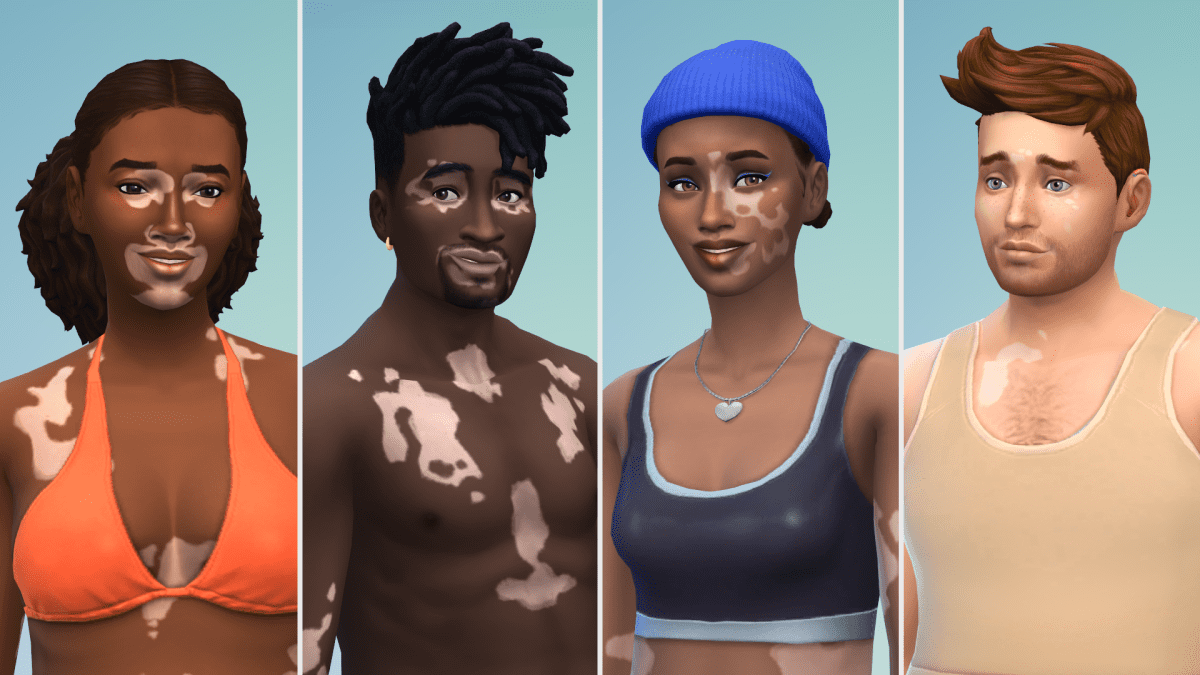 ‘The Sims 4’ adds vitiligo in free update