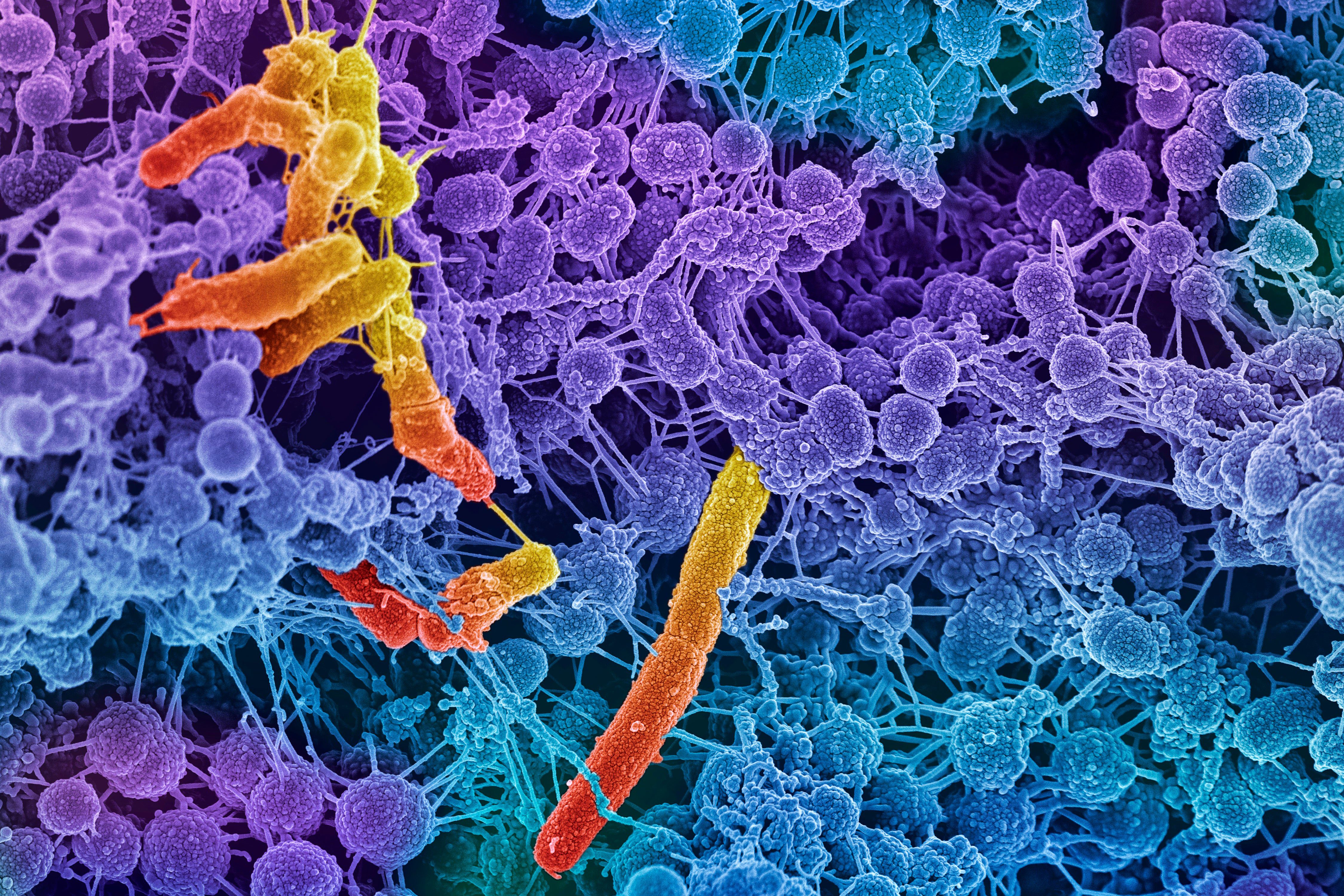 Weird ‘Obelisks’ Found in Human Gut May be Virus-Like Entities