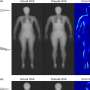 Researchers combine modern equipment for increased precision in body composition analysis