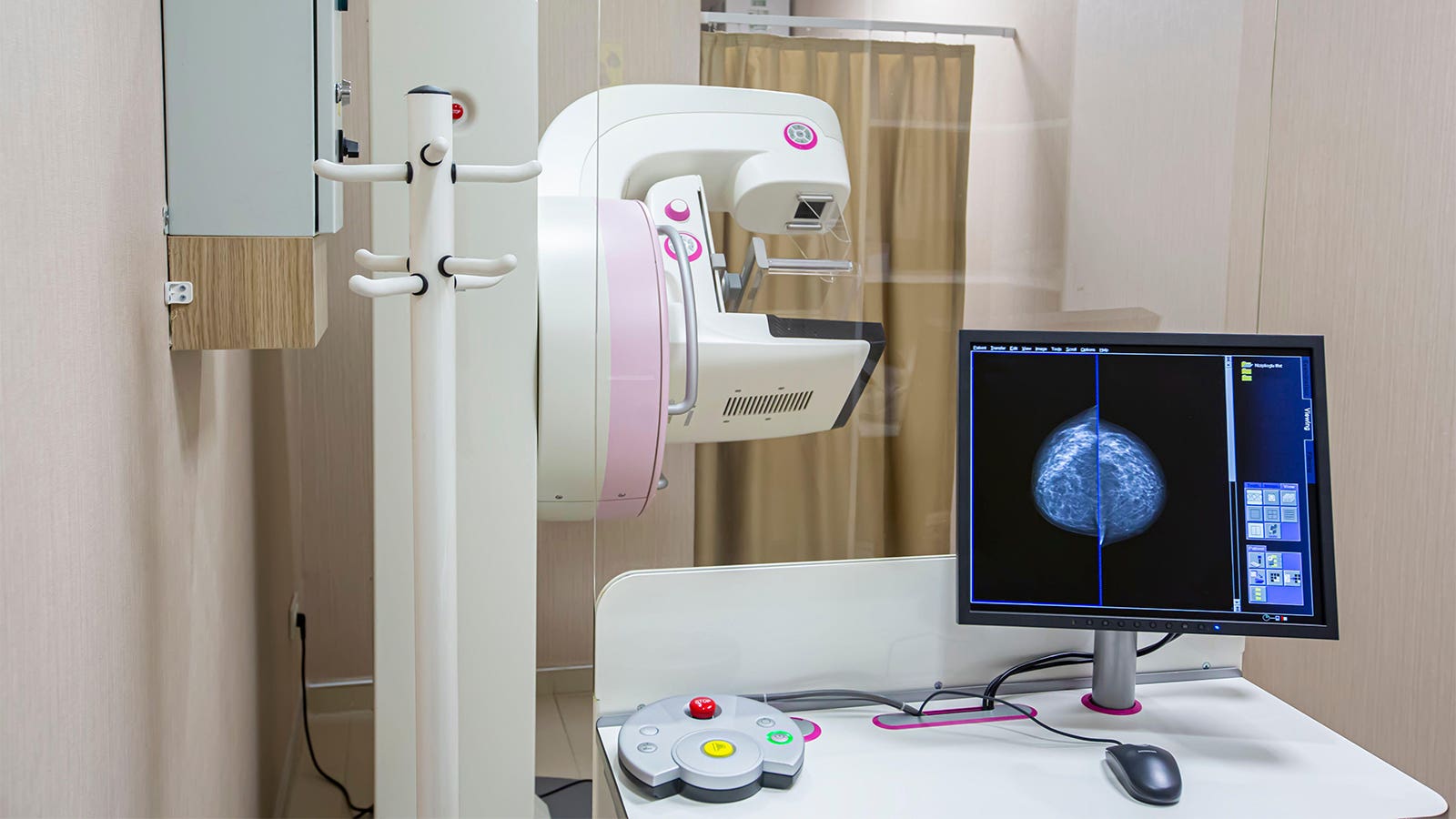 Annual Breast Cancer Screening Starting at Age 40 Best, Modeling Study Says