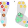 Research team analyzes hospital stay data, identifies key points where disease trajectories diverge