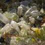 Study raises questions about plastic pollution’s effect on heart health