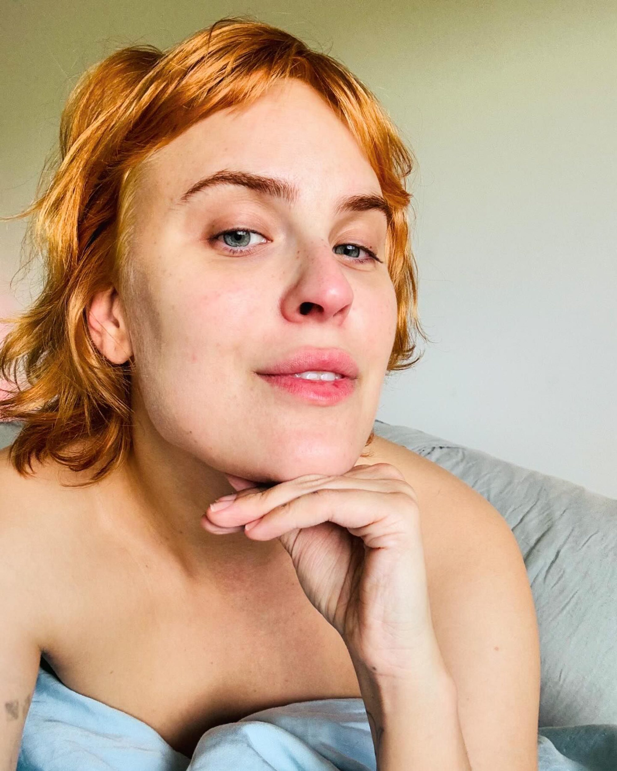 Tallulah Willis dissolves filler after six years, shows off ‘real bone structure’