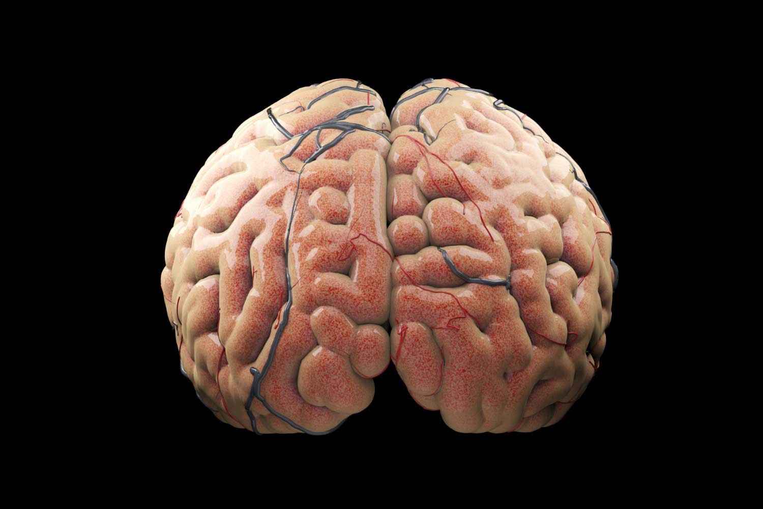 Larger human brains offer a protective effect against dementia