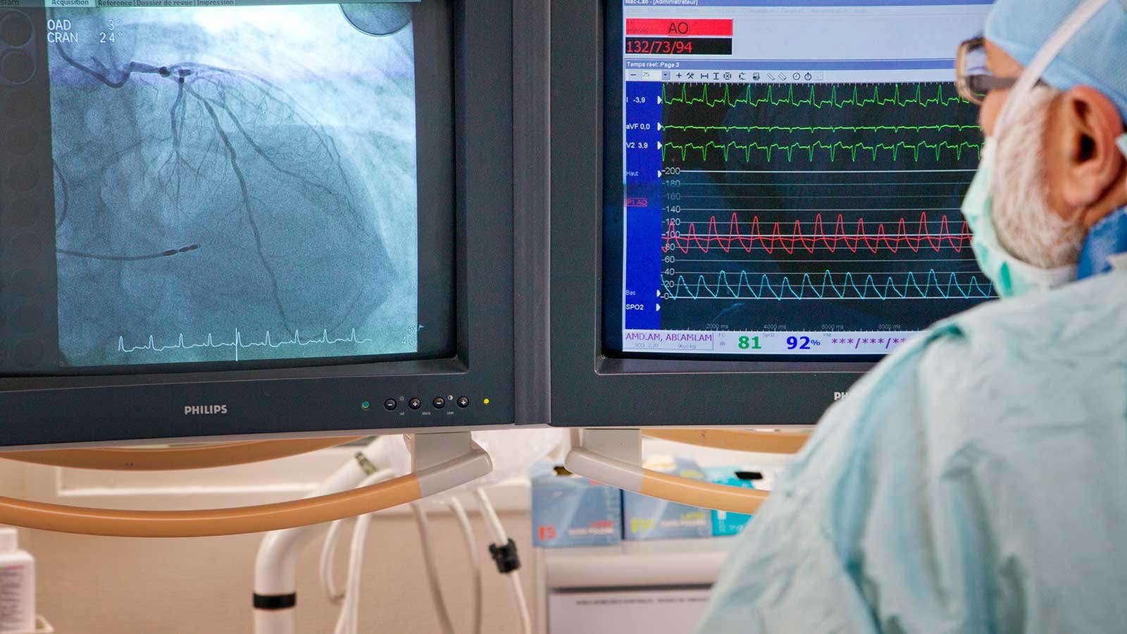 Culprit Lesion PCI Before Diagnostic Angiography for Faster STEMI Reperfusion