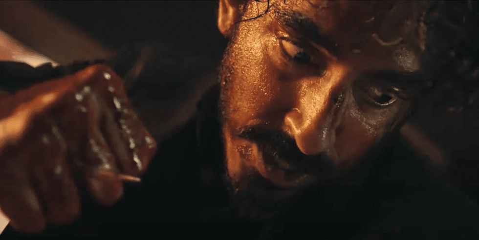 Dev Patel Broke His Hand Filming a Fight Scene in Monkey Man