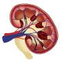 Lower levels of albuminuria associated with increased risk for chronic kidney disease progression and kidney failure