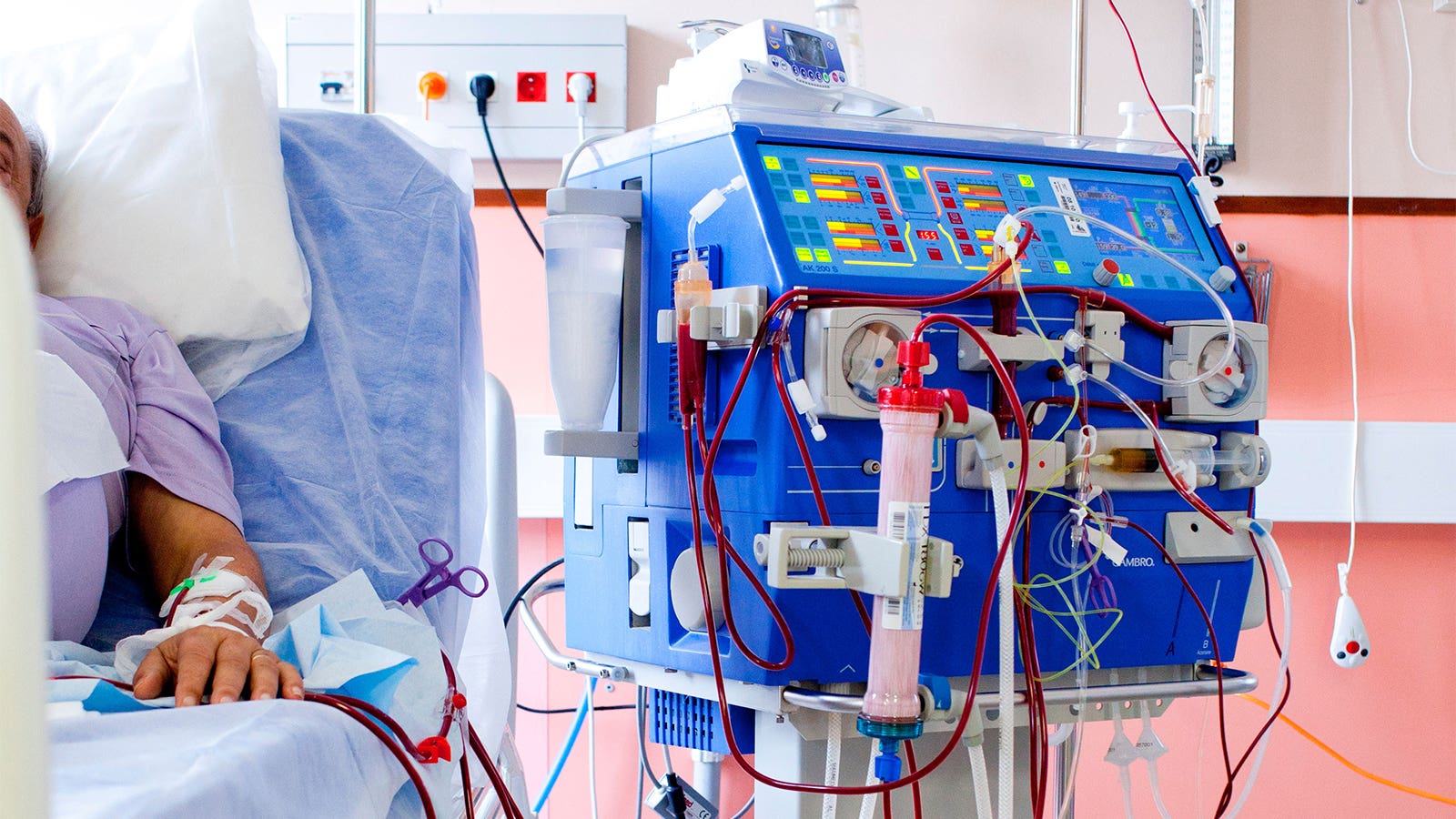 Primary Care Strategy Fails to Reduce Kidney-Dysfunction Triad Hospitalizations