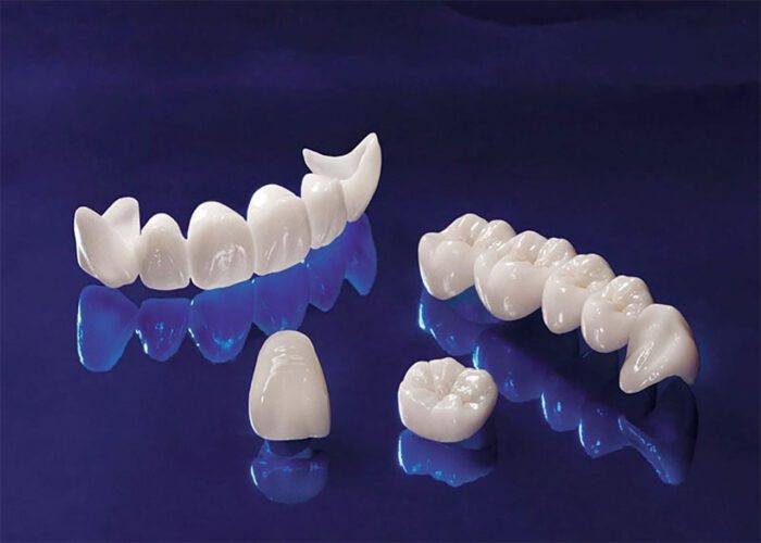 From Start to Smile ─ Unveiling the Zirconia Crown Creation Journey