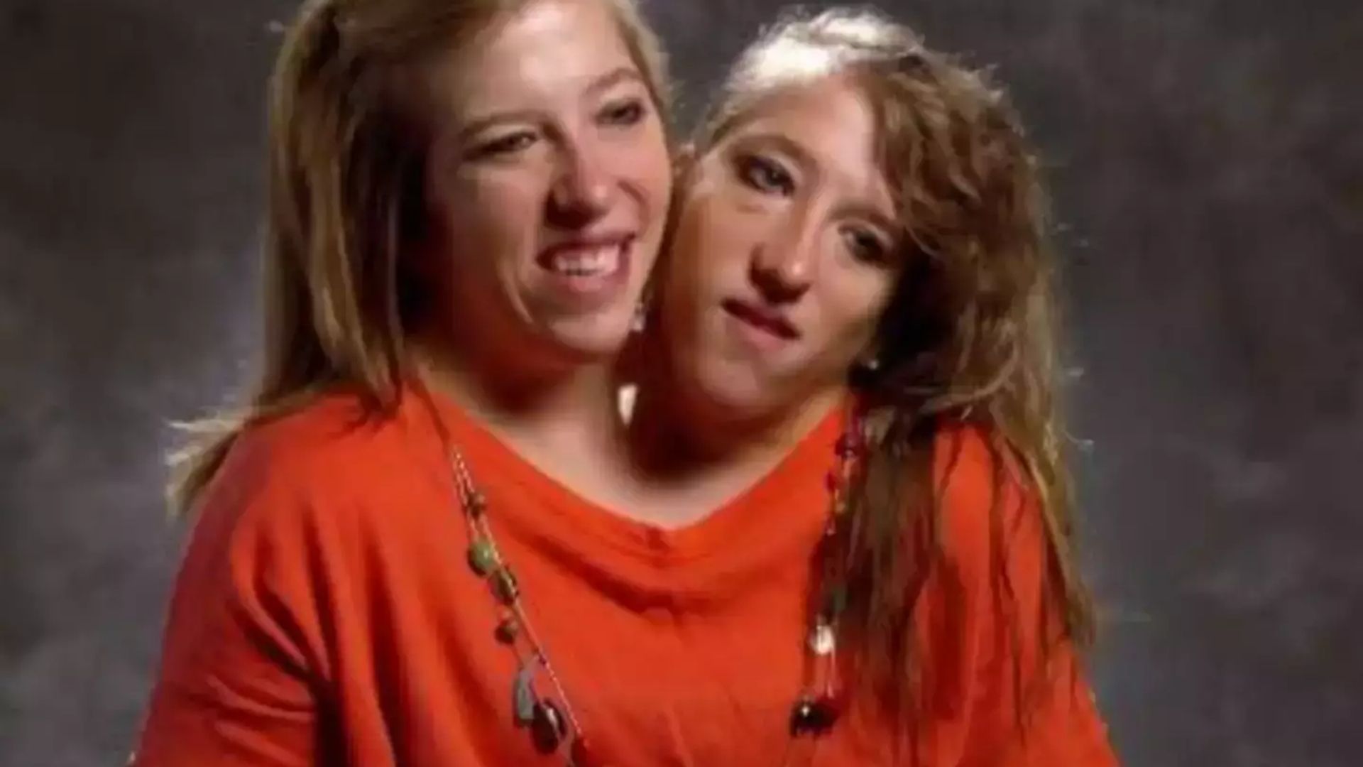 Conjoined twins Abby and Brittany Hensel reveal surprising details about their lives that will leave you speechless