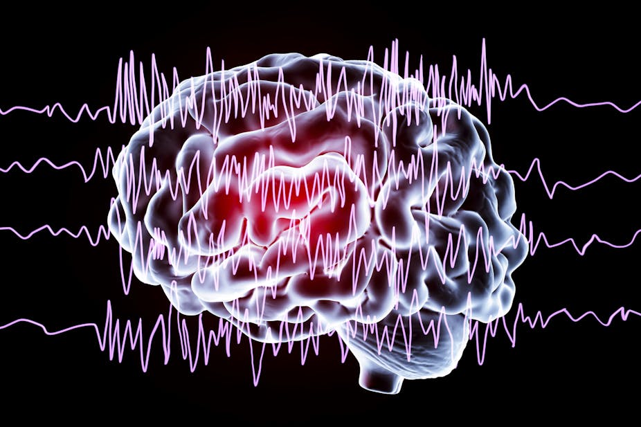 A Century After The EEG Was Discovered, It Remains A Crucial Tool For Understanding The Brain