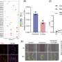 Elevated glutamine triggers stroke risk in moyamoya disease via endothelial‐to‐mesenchymal transition, finds study