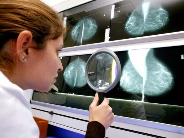 Common Chemicals: Breast Cancer Link?