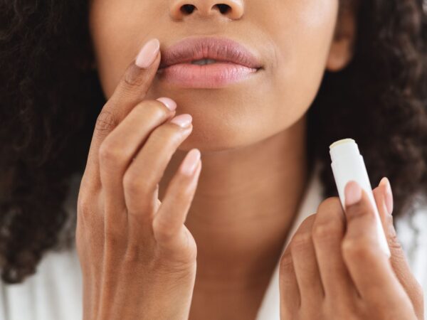 Are my chapped lips down to menopause? A dermatologist sets me straight