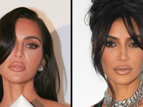 Kim Kardashian Sparks Concern With Her ‘Wonky Eye’ That She ‘Tries to Hide’; Nurse Weighs In