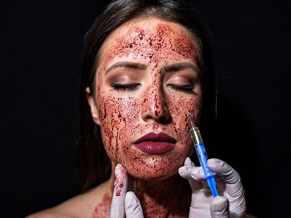 New HIV Infections After Vampire Facials at Unlicensed Spa