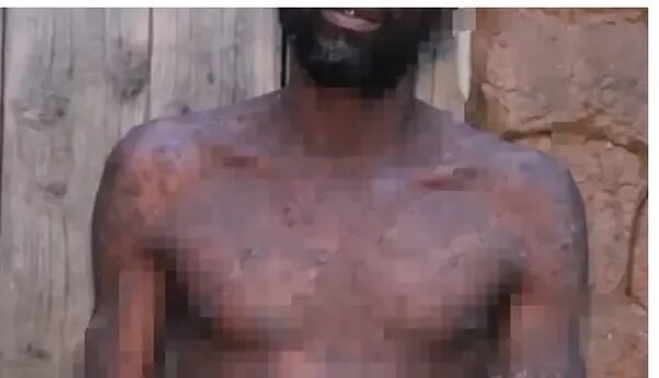 JUST IN: Please Let Me Die, the Pain Is Too Much, I Don’t Sleep at Night Because Of This.. – Man Pleads with God