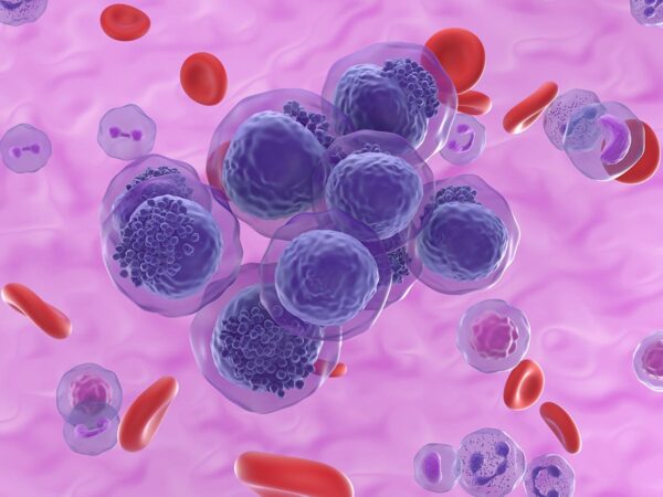 Venetoclax Combo Safe, Effective in AML Patients Age 80 and Up, Real-World Data Show